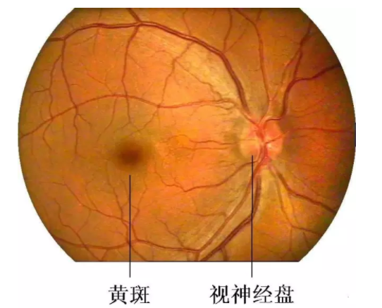 葉黃素是防止黃斑病變致老年失明的“視黃金”--驗(yàn)光師培訓(xùn)科普