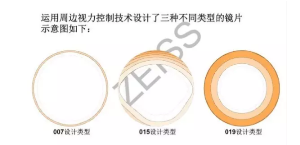 【驗光師分享】環(huán)焦、全焦和離焦這3種鏡片有什么區(qū)別？