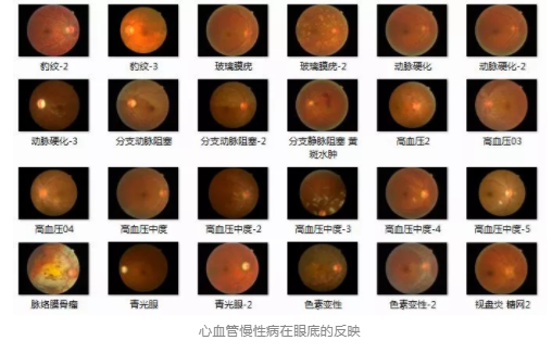 視光變革者寶島眼鏡CEO王智民：AI是慢性病、近視防控救星