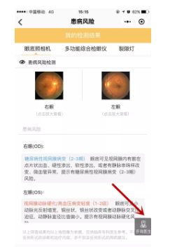 視光變革者寶島眼鏡CEO王智民：AI是慢性病、近視防控救星