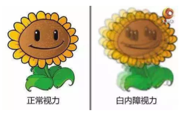 央視《健康之路》：你知道嗎？老花眼視力變好，有可能是患了白內(nèi)障