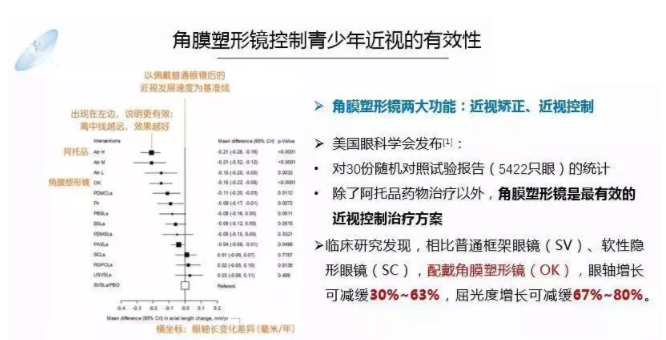 【眼視光前沿】一種具有非球面基弧設(shè)計的角膜塑形鏡